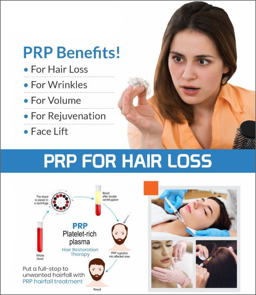 prp for hair loss